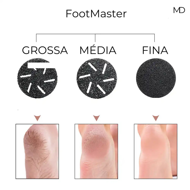 Dispositivo de Pedicure Elétrico FootMaster - Portátil e Recarregável (BRINDE EXCLUSIVO)