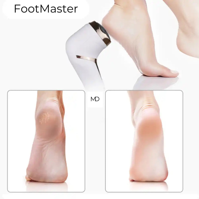 Dispositivo de Pedicure Elétrico FootMaster - Portátil e Recarregável (BRINDE EXCLUSIVO)