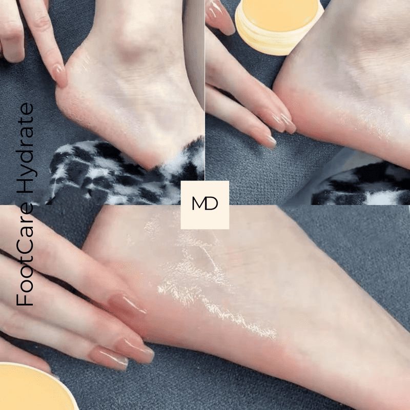 Hidratante FootCare - Hidratação Profunda e Reparação Rápida (LEVE 3 PAGUE 2)